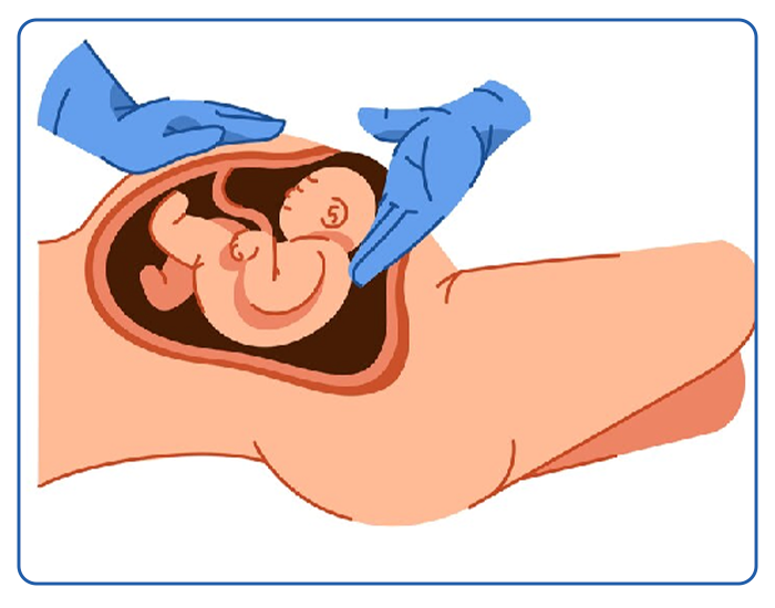C Section