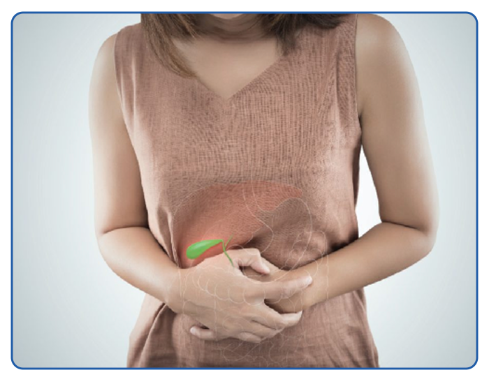 Gallbladder Removal