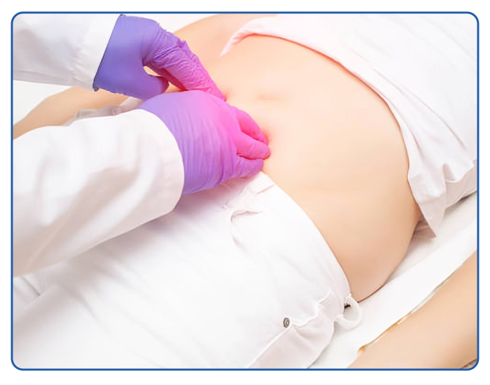 Hernia or Hydrocele