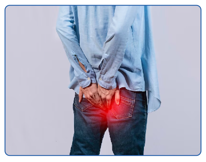 Piles Surgery